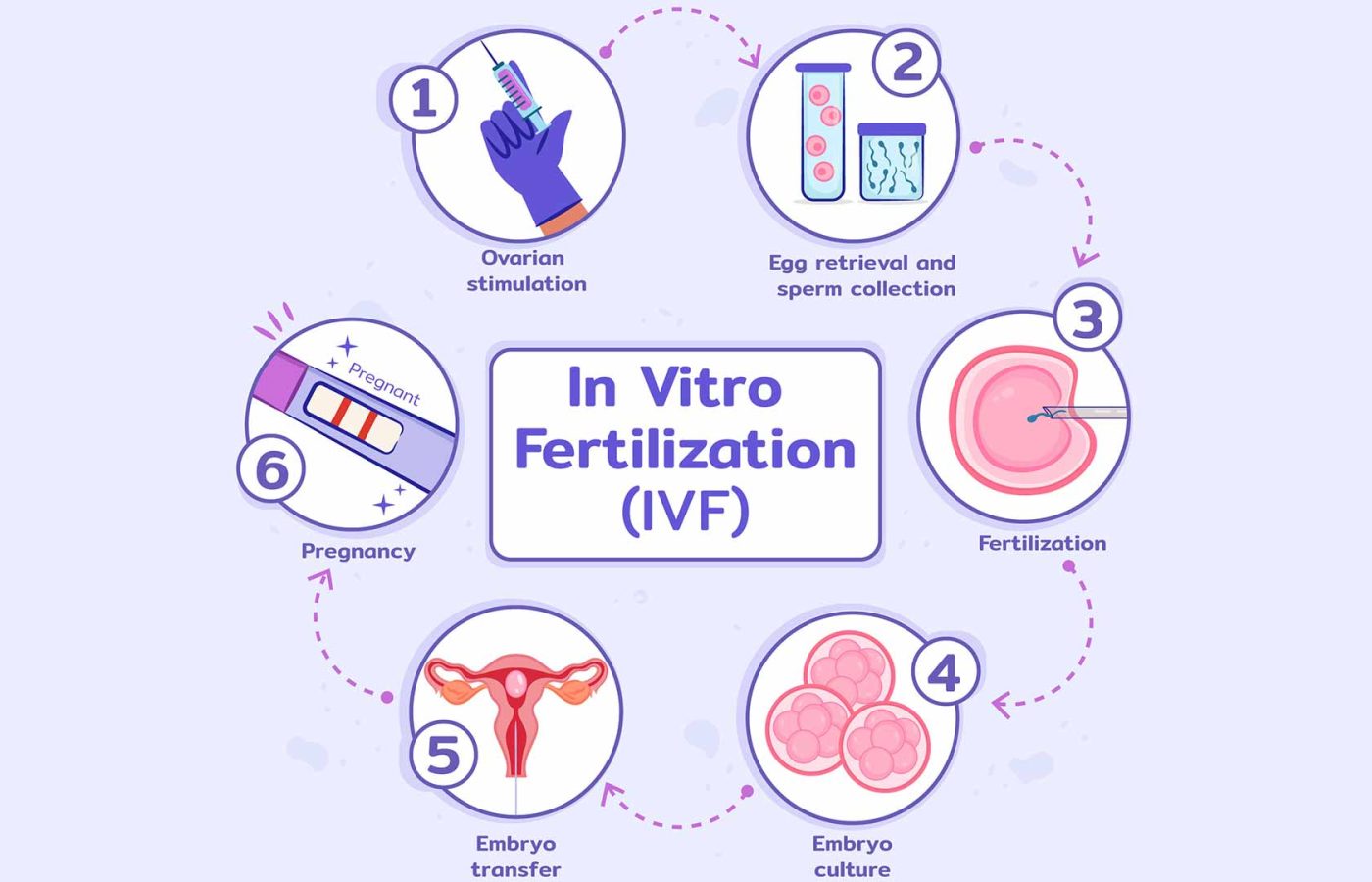 IVF